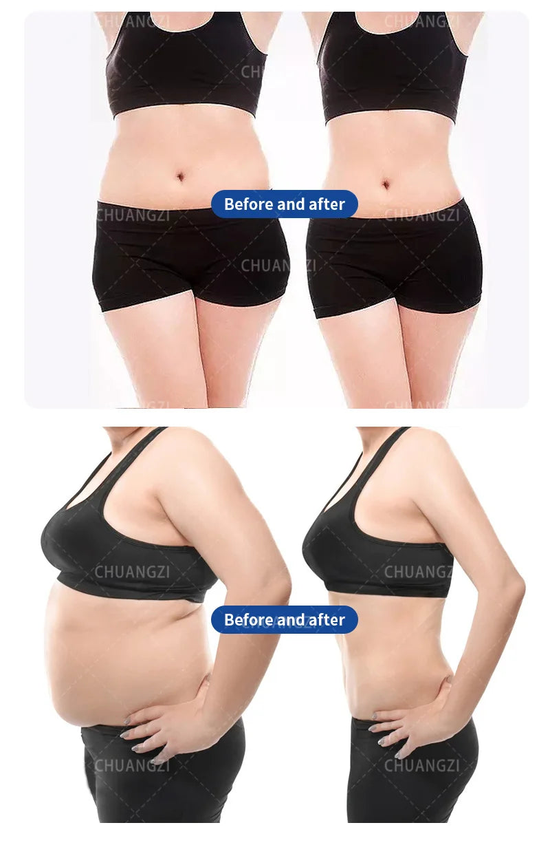 Body Sculpting, RF Fat Muscle Stimulation, Abdominal Burning,